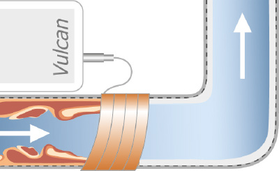 reduction of rust